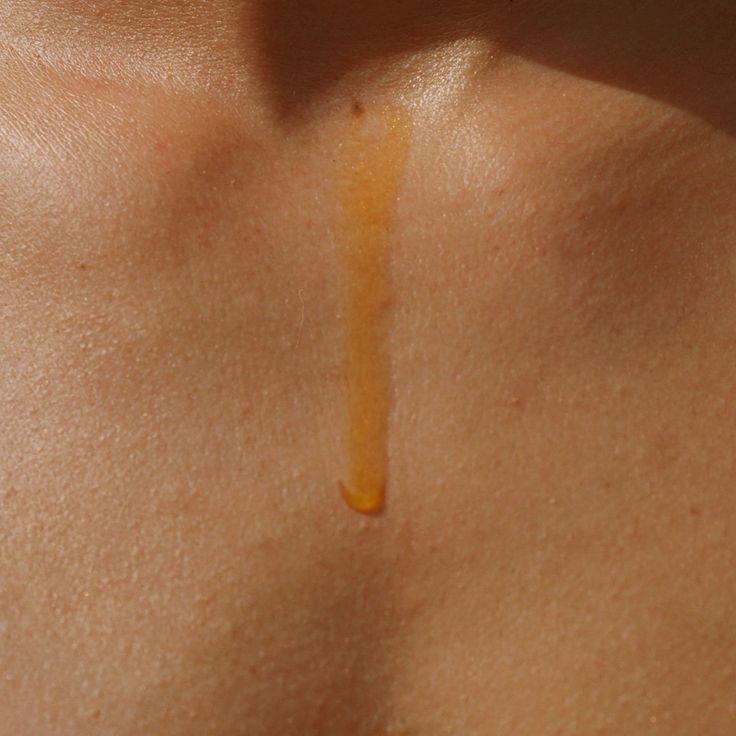 Vita Rosa Skin Brightening Rosehip Oil